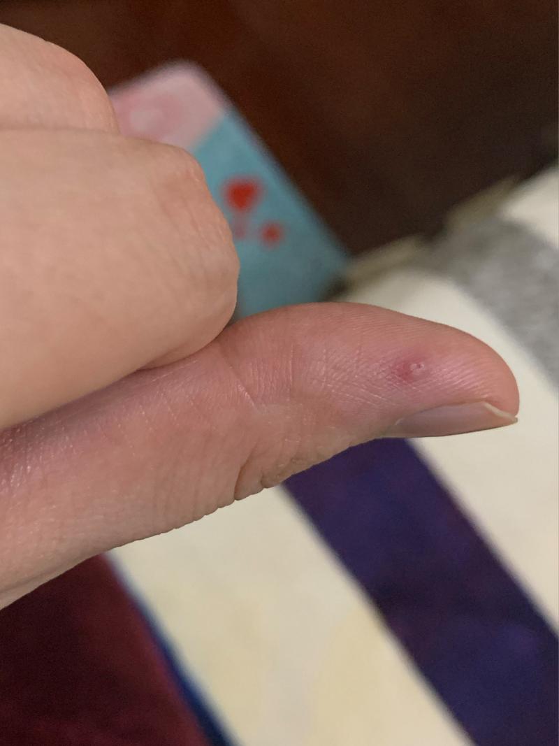 为什么只进了一个头太疼了(为什么只进了一个头太疼了：原因分析与解决方案)