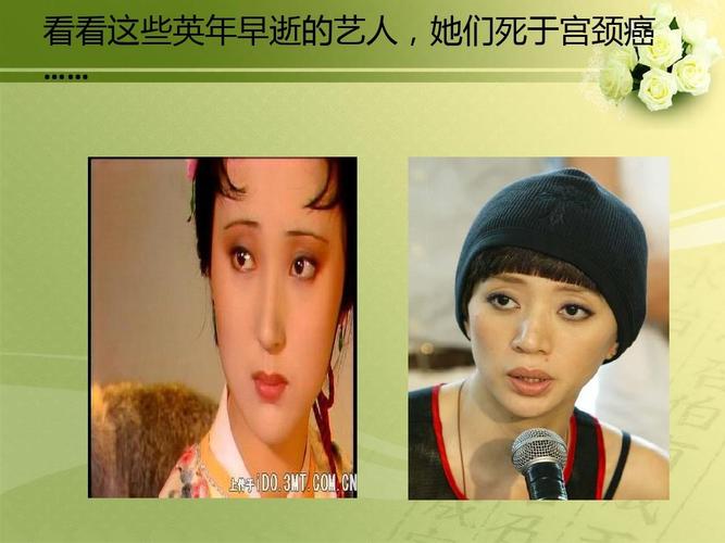 邓丽君性过度而死(邓丽君：性过度之谜，揭秘其真实死因)