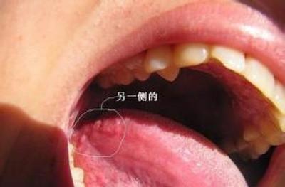 一边伸舌头一边快速喘气(伸舌头快速喘气：揭秘背后的生理现象)