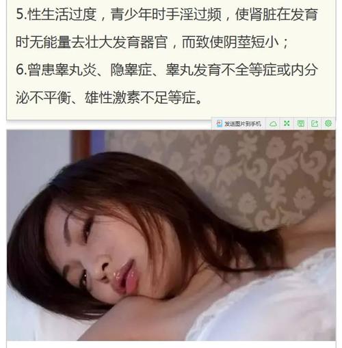 没带套子让他C了一天怎么办(没带套子C了一天：紧急避孕措施与性健康指南)
