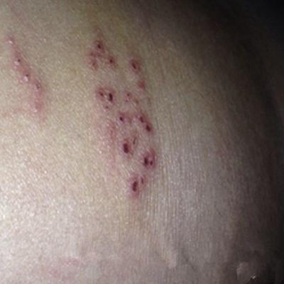 女性艾滋病最明显特征(女性艾滋病最明显特征：关键症状与识别指南)