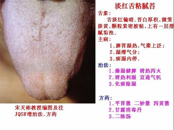 舌头往里面伸有一点点(舌头往里面伸有一点点：深入解析舌头异常现象的原因与影响)