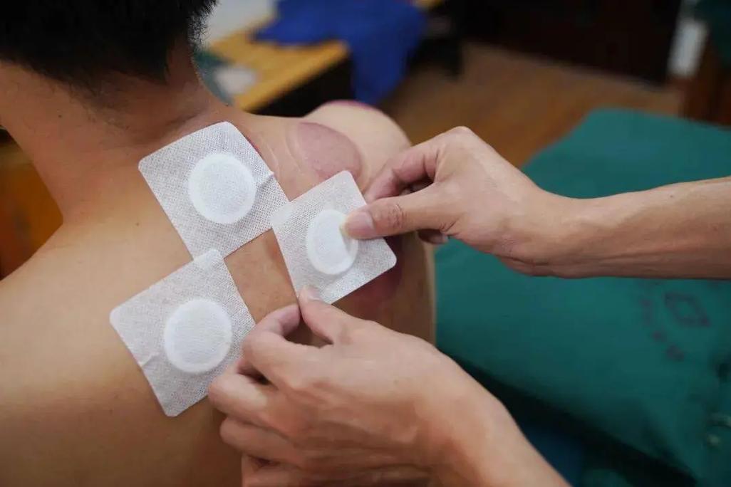 8种人千万不能艾灸(“8种人禁忌艾灸:详细说明艾灸的适用与禁忌人群”) 8种人千万不能艾灸(“8种人禁忌艾灸:详细说明艾灸的适用与禁忌人群”)