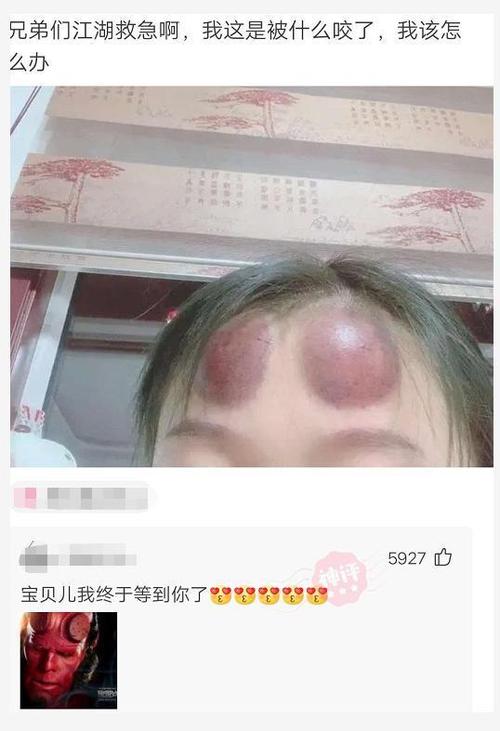 两只头头被吸肿了(两只头头被吸肿了：揭秘背后的原因与处理方法)
