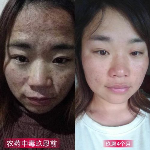 邦尼延时汀怎么样(邦尼延时汀效果评价：深入解析与用户反馈)
