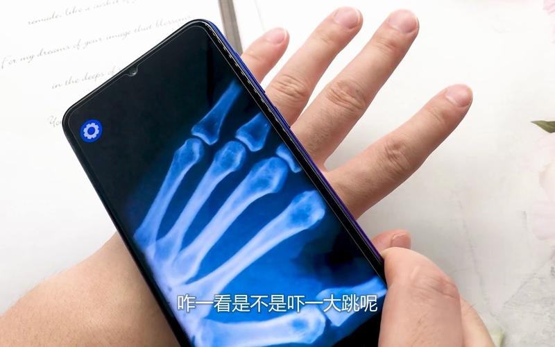 手机骨骼扫描软件苹果(手机扫描骨骼真正的版)