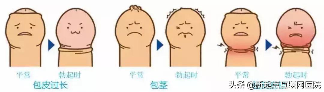 22cm对于女孩子来说怎么样(成年男子割包好处和坏处)