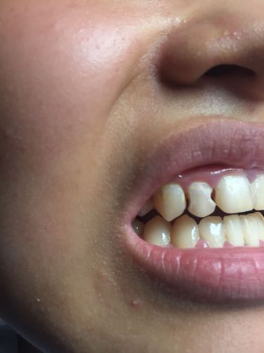 3根一起会坏掉的好痛