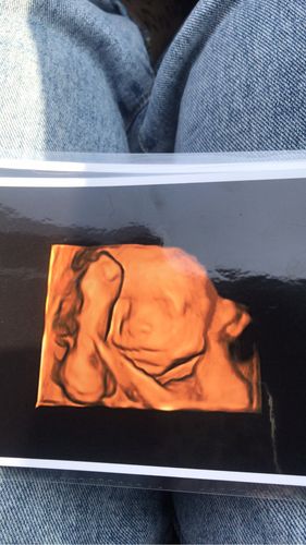 用什么软件能把男孩照片变成女孩(怎么把男孩照片变成女孩)