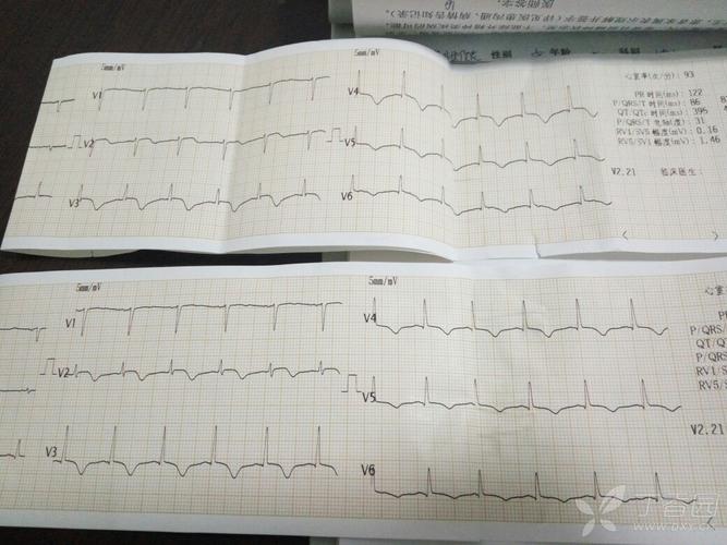 null是什么意思(心电图null是什么意思)