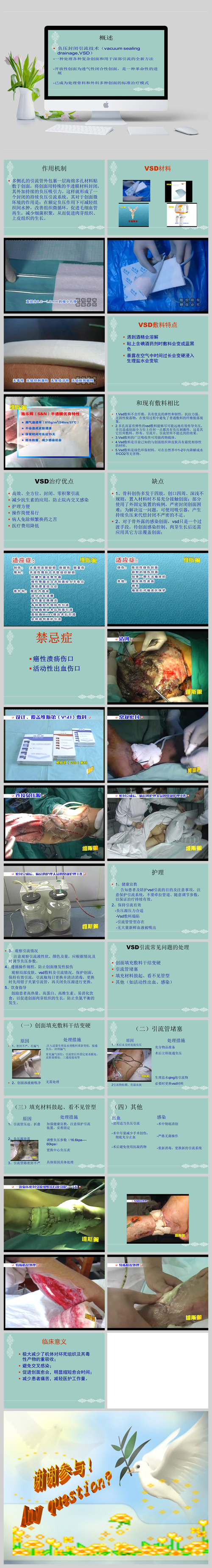 外科VSD是什么意思(医院vsd是什么意思)